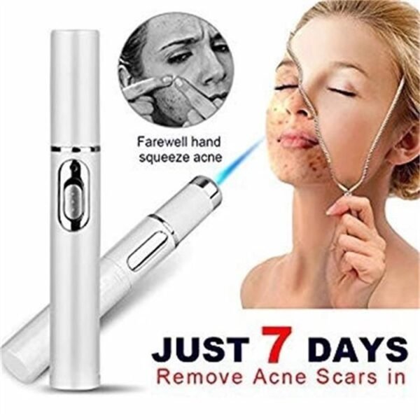 Stylo laser pour le traitement de l'acné par thérapie à la lumière bleue – Appareil de soin de la peau et de beauté pour l'élimination des cicatrices légères et des rides
